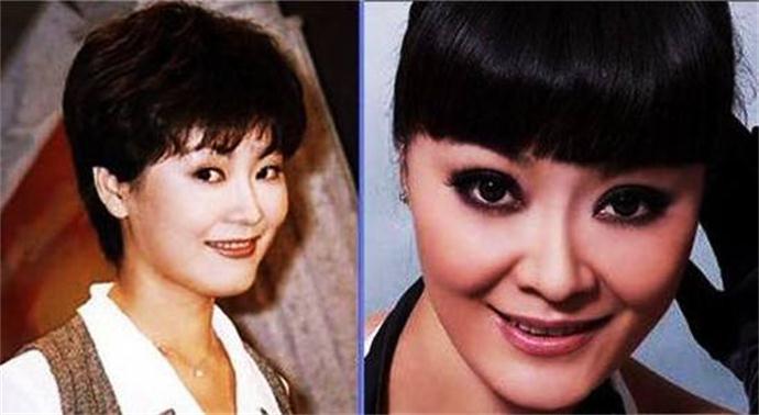 王小骞整容前后照片 整个脸型都有不小的变化让人不敢认