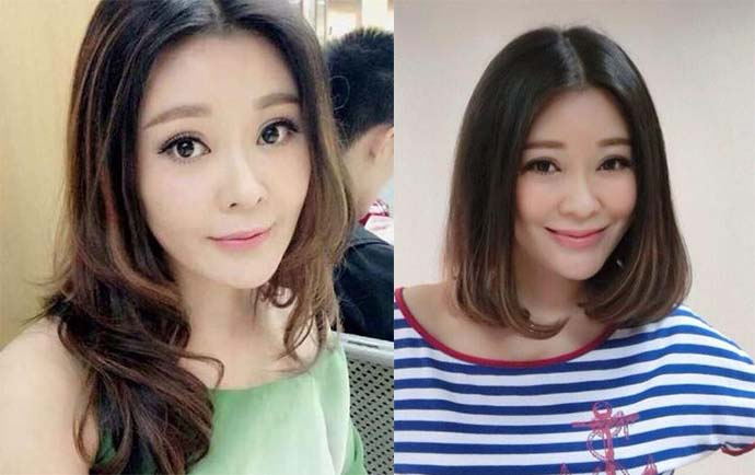 王小骞整容前后照片 整个脸型都有不小的变化让人不敢认