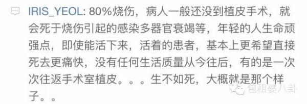 唐安琪被谁害的（揭秘SNH48唐安琪烧伤事件）