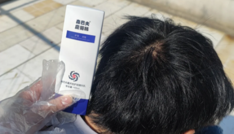 魔术丝能治秃顶吗（魔术丝能生发吗有效果吗）
